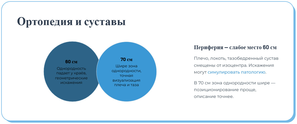 Чем МРТ с гентри 60 см отличается от 70 см и где используется